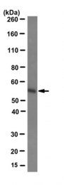 AM50444PU-N - Estrogen receptor beta