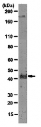 AM50472PU-N - WNT1