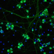 AM50502BT-N - Neurofilament H (200 kD)