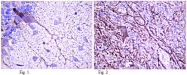 AM50522PU-N - HCN1 / BCNG1