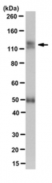 AM50551PU-N - Brevican core protein