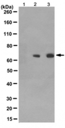 AM50580PU-N - Beta-ARK-1 / ADRBK1