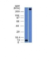AM50650PU-N - von Willebrand factor (VWF)