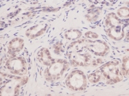 AP01112PU-N - VEGF-A