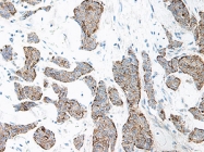 AP01118PU-N - Interleukin-17A (IL17A)