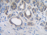 AP01137PU-S - Interleukin-2 / IL2