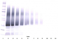 AP01139PU-N - IGFBP5