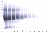 AP01139PU-N - IGFBP5