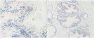 AP01140PU-S - NANOG