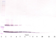 AP01155PU-N - TSLP