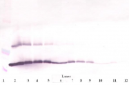 AP01155PU-N - TSLP