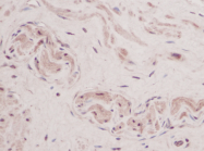 AP01155PU-N - TSLP