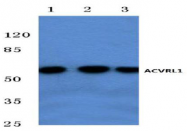 AP01172PU-N - ACVRL1 / ALK1