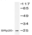 AP01175PU-N - SFRS3