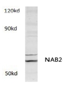 AP01179PU-N - NAB2