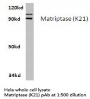 AP01183PU-N - ST14 / Matriptase