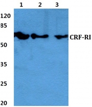 AP01194PU-N - CRHR1
