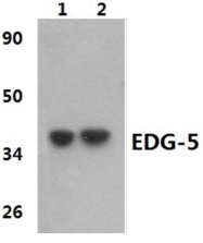 AP01198PU-N - EDG5 / S1P2
