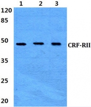 AP01213PU-N - CRHR2