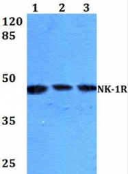 AP01219PU-N - Tachykinin receptor 1 (TACR1)