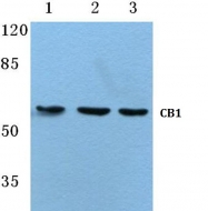 AP01265PU-N - Cannabinoid receptor 1