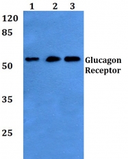 AP01269PU-N - Glucagon receptor