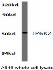AP01285PU-N - InsP6 kinase 2 / IP6K2