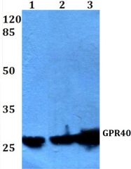 AP01314PU-N - FFAR1 / GPR40