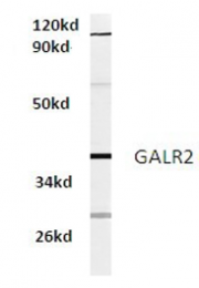 AP01317PU-N - GALR2