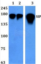 AP01369PU-N - ZFHX1B