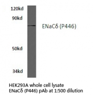 AP01381PU-N - ENAC delta / SCNN1D