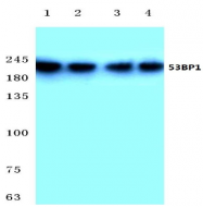 AP01409PU-N - ACSL6