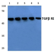 AP01457PU-N - TGFBR1 / ALK-5