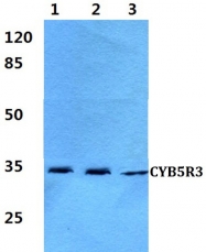 AP01486PU-N - CYB5R3