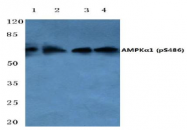 AP01523PU-N - PRKAA1