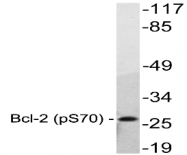 AP01536PU-N - Bcl-2