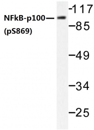 AP01642PU-N - NFKB2 / NF-kappa-B p100/p52