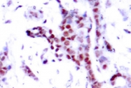 AP01689PU-N - STAT1