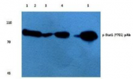 AP01689PU-N - STAT1