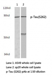 AP01705PU-N - MAPT / TAU