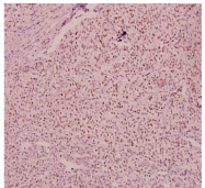AP01835PU-N - MEF2D