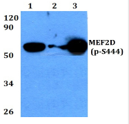 AP01835PU-N - MEF2D