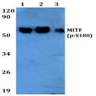 AP01837PU-N - MITF