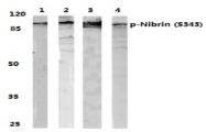 AP01891PU-N - Nibrin