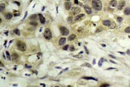 AP01891PU-N - Nibrin