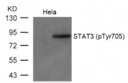 AP02344PU-S - STAT3