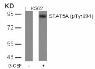 AP02347PU-S - STAT5 / STAT5A