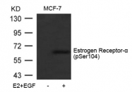 AP02368PU-S - Estrogen receptor alpha