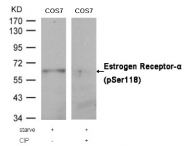 AP02370PU-S - Estrogen receptor alpha