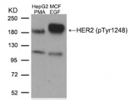 AP02377PU-S - CD340 / ERBB2 / HER2